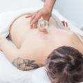 client on a massage table receiving cupping therapy